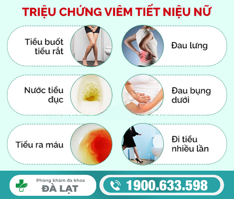 Hình ảnh minh họa